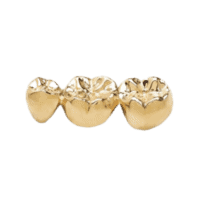 gold teeth